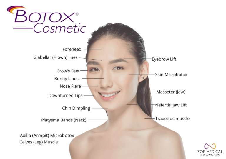 Botox Price in Singapore: Your Complete 2024 Guide