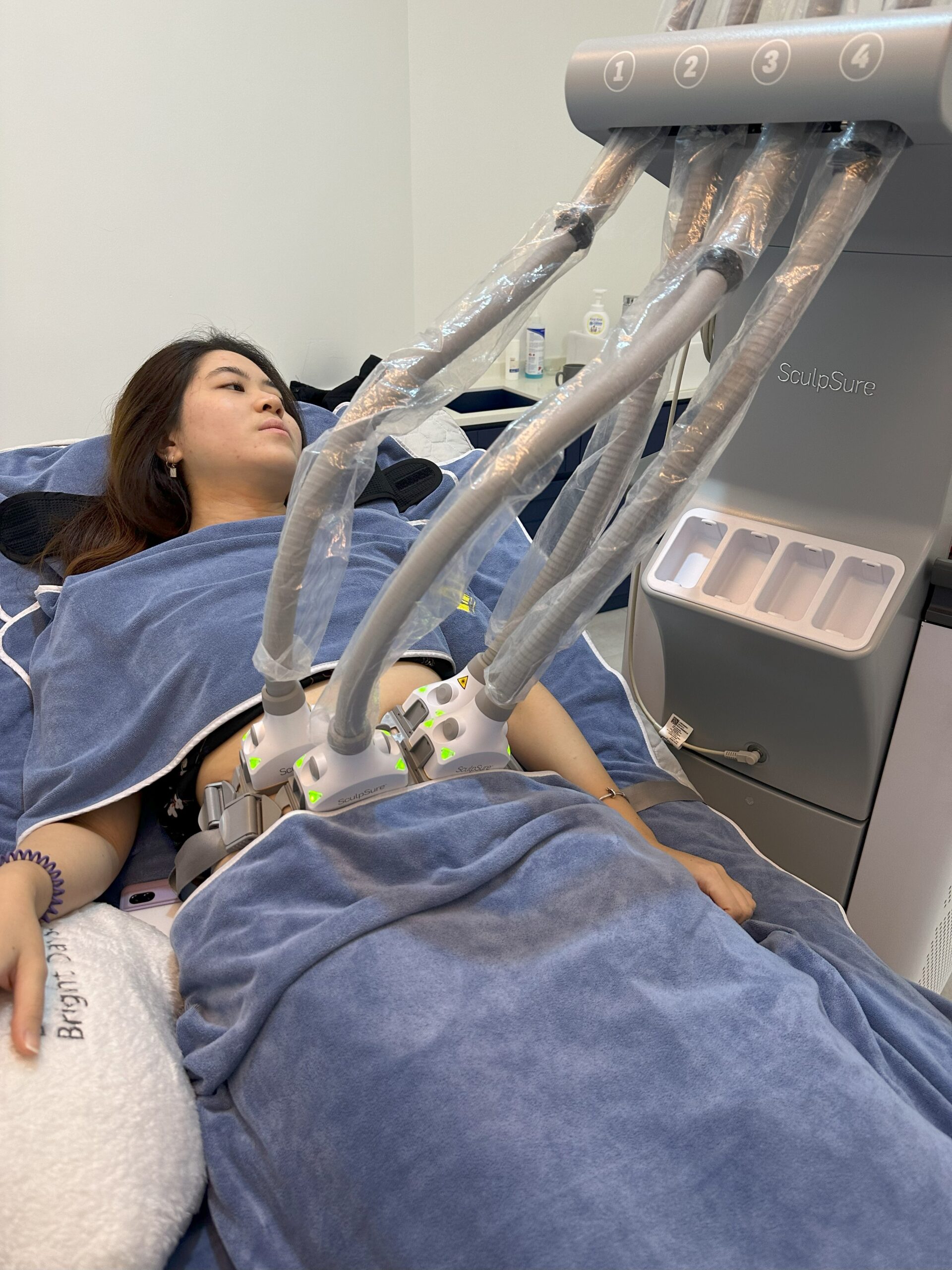 SculpSure Laser Lipolysis (Fat Reduction) - Bay Aesthetics Clinic and ...