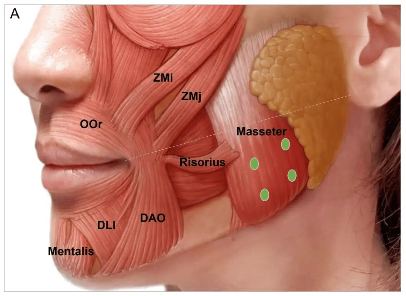 Jaw Botox Masseter Botox In Singapore For Slimmer Contours Jaw Botox Masseter Botox In Singapore For Slimmer Contours
