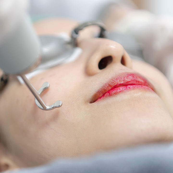 glutathione skin whitening injection singapore Melasma Pigmentation Treatment Singapore: What Really Works? brand:portioncontrol Iron-Rich Hematopoiesis-Promoting Dextran Iron Style:Step 3 - Fine