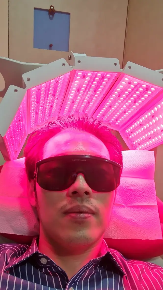 Dr Bernard Tan (Medical Director & Founder of Bay Aesthetics Clinic) getting LLLT for hair growth