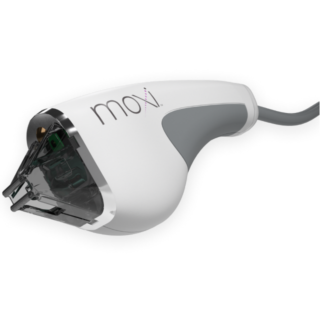 MOXI Laser for hand rejuvenation