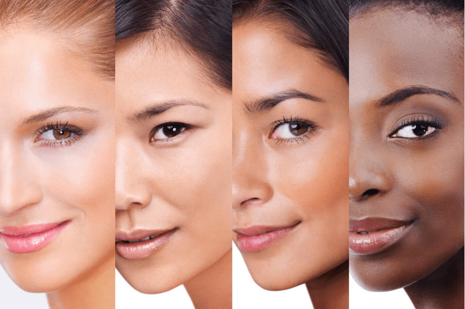 Darker skin types and skin of colour requires more experience and skill to treat